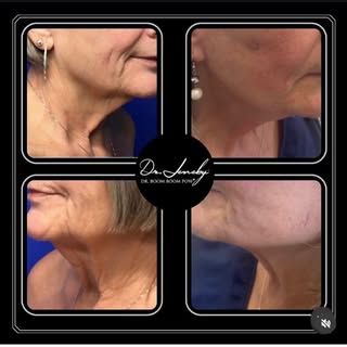 🤯 BEFORE AND AFTER TIME! 🤯 

Check out these incredible results from the one and only Dr. Jeneby! 