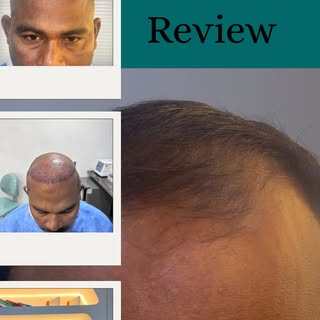 “A new chapter begins today. 📖

Hair restoration is about so much more than just hair—it’s about ho