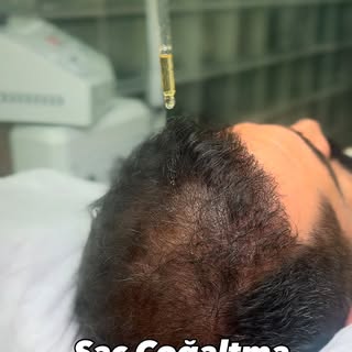 📌 Uyarı: Paylaşımlarımız bilgilendirme niteliğindedir.
✅ Tüm cerrahi ve estetik işlemlerde sonuçlar