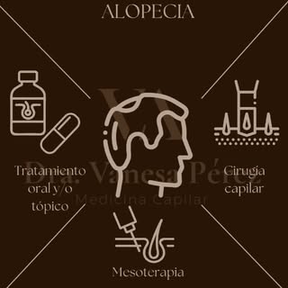 3 soluciones para la alopecia