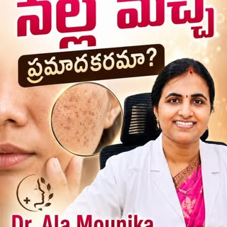 ప్రతి నల్ల మచ్చ సాధారణ మోల్ కాదు. కొన్నిసార్లు అది చర్మ క్యాన్సర్‌కు సంకేతం కావచ్చు. డెర్మస్కోపీ వంట