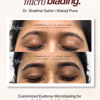 Achieve beautifully defined, natural-looking eyebrows with expert Microblading at Eyebrow Lips Scalp