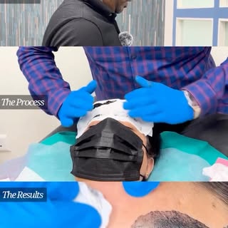Every natural-looking microblading result begins with expert brow mapping, facial analysis, and a te