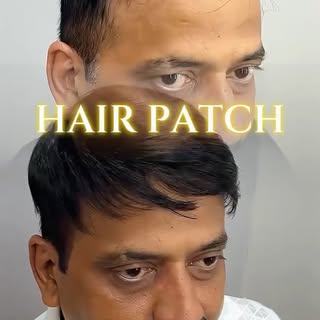 Real hair. Real confidence. Zero surgery. 💫

Watch how a custom-fitted hair patch transforms thinni