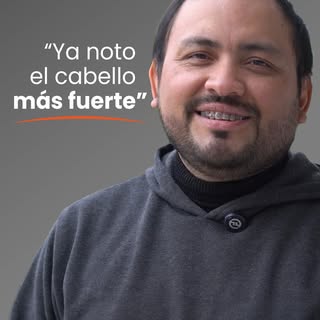 Antes, las fotos eran algo que prefería evitar.

Hoy, en su tercera sesión de mesoterapia capilar, d