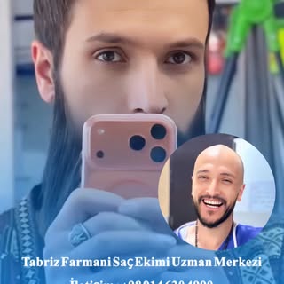 “Türkiye’den gelen değerli danışanımızın saç ekimi memnuniyet videosu”

Türkiye’den merkezimize gele