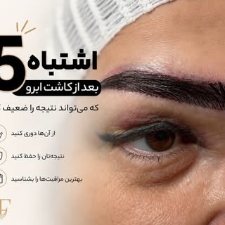 ✅ با رعایت توصیه‌های پزشک، صبوری در دوران ترمیم و انجام مراقبت‌های لازم، می‌توانید بهترین نتیجه را ا