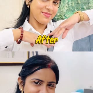 Want glowing skin visit Nyra skin & hair clinic🤩🤌🏻

📍Nyra skin & Hair clinic, nirala nagar, luck
