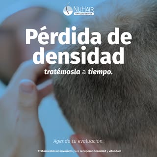 🧬 Notar cómo tu cabello va perdiendo densidad poco a poco puede ser angustiante, y entendemos perfe