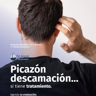 💇🏽‍♀️ Cuando el cuero cabelludo pica, se engrasa o se descama, es normal que te sientas incómodo. 