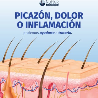 💆🏽‍♀️ A veces aparecen esos “granitos” en el cuero cabelludo que pican o duelen. Sabemos lo molest