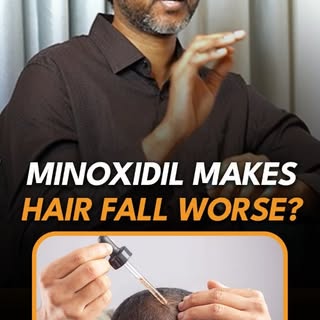 Minoxidil without proper guidance — will it cause existing hair to fall?
Many people fear that using