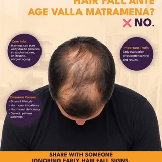 Think hair fall happens only because of age? Think again. 

Hair loss can start much earlier than yo