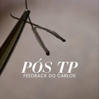 Recebemos o Carlos para acompanhar a evolução do seu tratamento após o transplante capilar. Esta só 