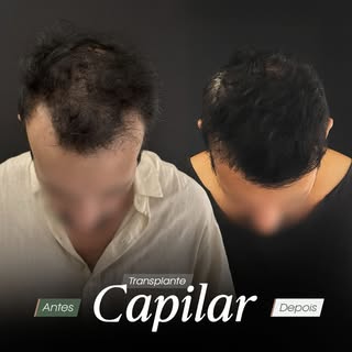 ✅ Cada paciente apresenta um padrão de resposta biológica próprio, por isso, o planejamento é indivi