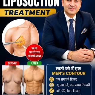 Liposuction #cosmeticsurgery #botox #skincare #plasticsurgery #skin