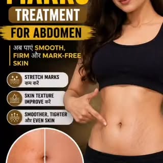 Stretch Mark 😌#laser#botox#foryou#skincare #cosmeticsurgery