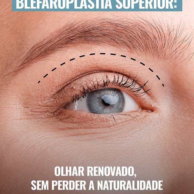 Lembrando sempre que toda avaliação é individual. Converse com seu dermatologista:

Informações sobr