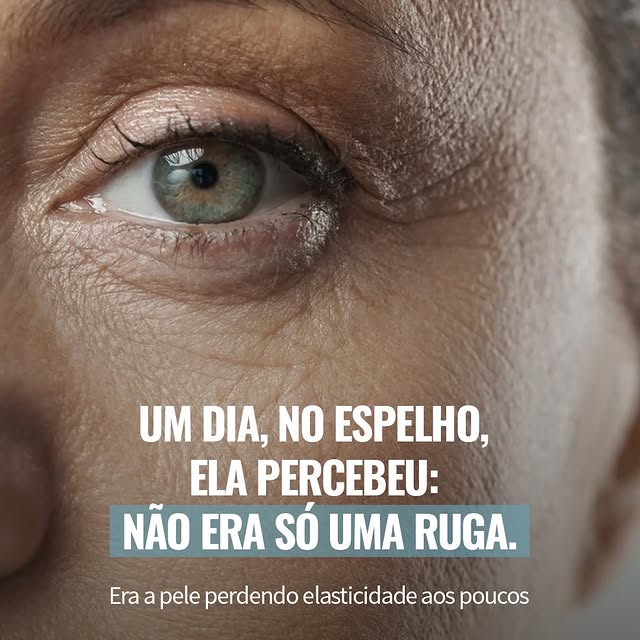Muitas vezes, o incômodo não é exatamente uma ruga isolada. É a sensação de que a pele perdeu firmez