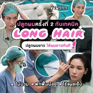 คุณโม จิรัชยา ปลูกผมครั้งที่ 2‼️ ที่ #medihair เทคนิค Long Hair FUE ปลูกผมยาว ได้แนวไรผมสวยใหม่ทันที