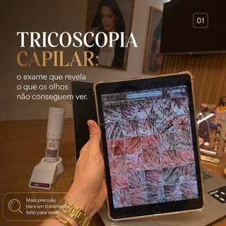 Você sabia que nem toda queda de cabelo tem a mesma causa?

Antes de iniciar qualquer tratamento cap