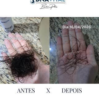 Menos fios no ralo, mais confiança no espelho✨

Em apenas 28 dias, já é possível observar uma reduçã
