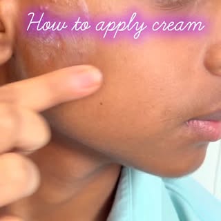 How to Apply Cream on Your Pimples | Dr. Vijay Singhal

Many people use acne creams the wrong way, w