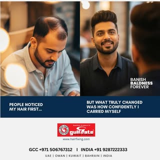 It’s never just about the hair—it’s about how you feel when you look in the mirror. 💼✨

A full head