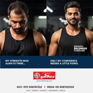 Confidence looks better on you.

Hair loss doesn't define who you are—your confidence does. At Gulf 