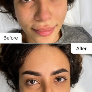 small change BIG IMPACT ! 
Same you, just more confident :) 
✨naturally enhanced 
✨perfectly shaped
