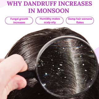 Humidity could be the hidden reason behind your dandruff! 👀🌧️

Monsoon humidity can make your scal