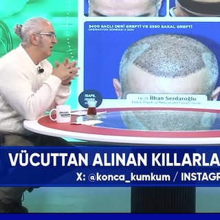 TELE 1’de yayınlanan Konca Kumkum’un sunduğu Sağlık Gündemi programından.

#saçkimi #hairtransplant 