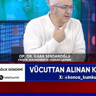 TELE 1’de yayınlanan Konca Kumkum’un sunduğu Sağlık Gündemi programından.

#saçkimi #hairtransplant 