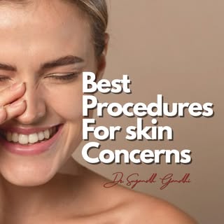 Best Skin Procedures for skin concerns ✨
#dermat #shineskinclinic #drsugandhgandhi #skinconcerns #gl