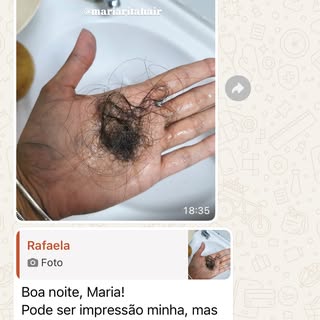 Você já percebeu aqueles fiozinhos novos aparecendo na entrada do cabelo…

Mas os meses passam e ele
