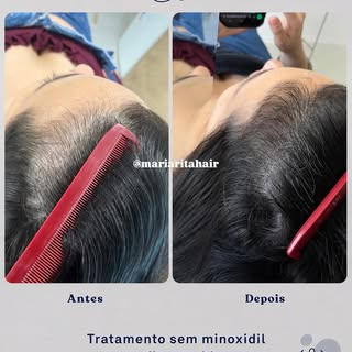 Muita gente só percebe o quanto o cabelo afinou quando vê uma foto tirada de cima… com a luz batendo