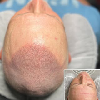 You don’t have to like me or my character but let’s face it you’re gonna respect my scalp micropigme