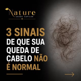3 sinais de que sua queda de cabelo não é normal.

Perder alguns fios por dia é esperado. O problema