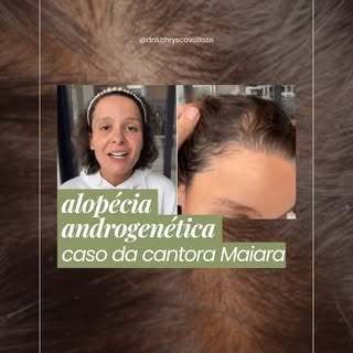 O relato de Maiara trouxe à tona uma conversa que muita gente evita: problemas capilares não são ape