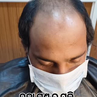 #price 3999/- #humanhair #thehairrenovation #hairpatch #hairwig #hairreplacment #haircut #haircare #