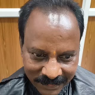 Cliping hair patch #କମ୍ ଖର୍ଚ୍ଚ ରେ ଚନ୍ଦା ପଣ ରୁ ମୁକ୍ତି #The hair ରେନୋଭେସନ#flat 30%discount#odisha bhub