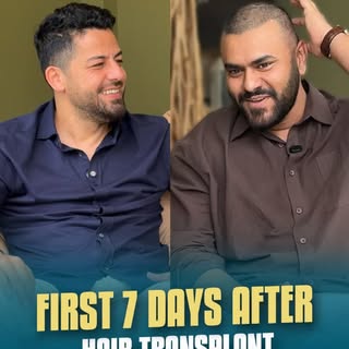 FIRST 7 DAYS AFTER HAIR TRANSPLANT | REAL PATIENT EXPERIENCE | DR. BIRCAN

Full video on Dr. Bircan 