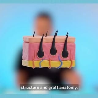 5 Mistakes That Should Not Be Made in Hair Transplantation Graft Extraction! | Dr. Bircan

Full vide