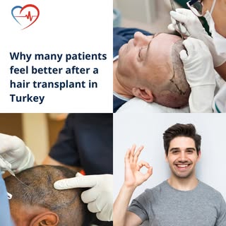 We often focus entirely on the physical results of a hair transplant—the new hairline, the density, 