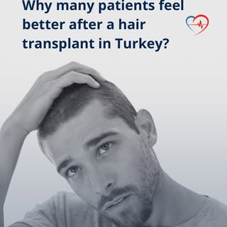 When we talk about hair transplants, we usually focus on the physical results—the hairline, the dens