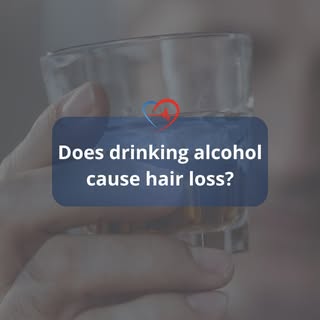 Alcohol and hair loss might seem unrelated, but alcohol actually acts as a quiet, indirect disruptor