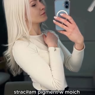 Mam naturalnie siwe włosy od kilku lat🧝🏻‍♀️
Ten proces to utrata pigmentu w wyniku łysienia placko
