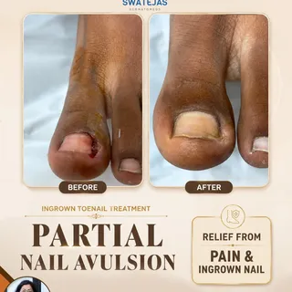Say goodbye to the pain of ingrown toenails! 👣

An ingrown toenail can cause persistent pain, swell