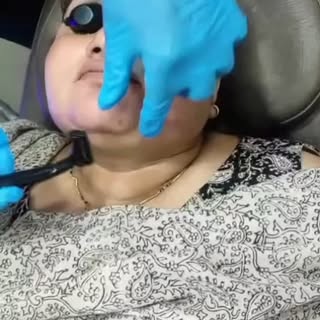 #laserhairreduction