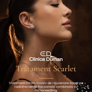 Scarlet + Microneedling – combinația ideală pentru stimularea producției de colagen și obținerea unu